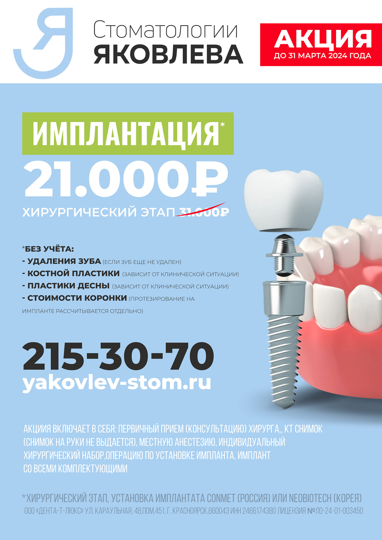 Скидка на имплантацию зубов в Красноярске - Стоматологии Яковлева