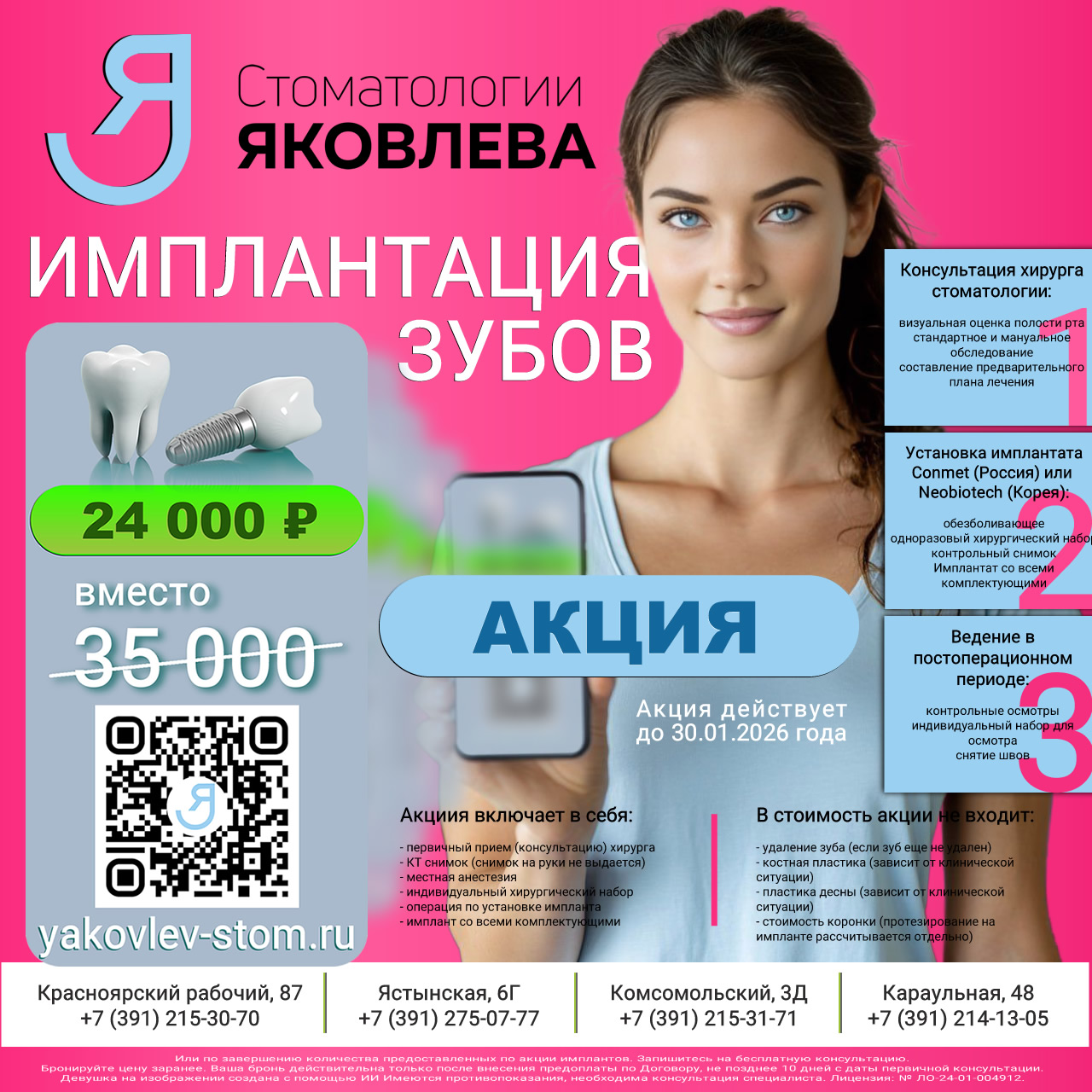 Имплантация зубов со скидкой в Красноярске - Стоматологии Яковлева