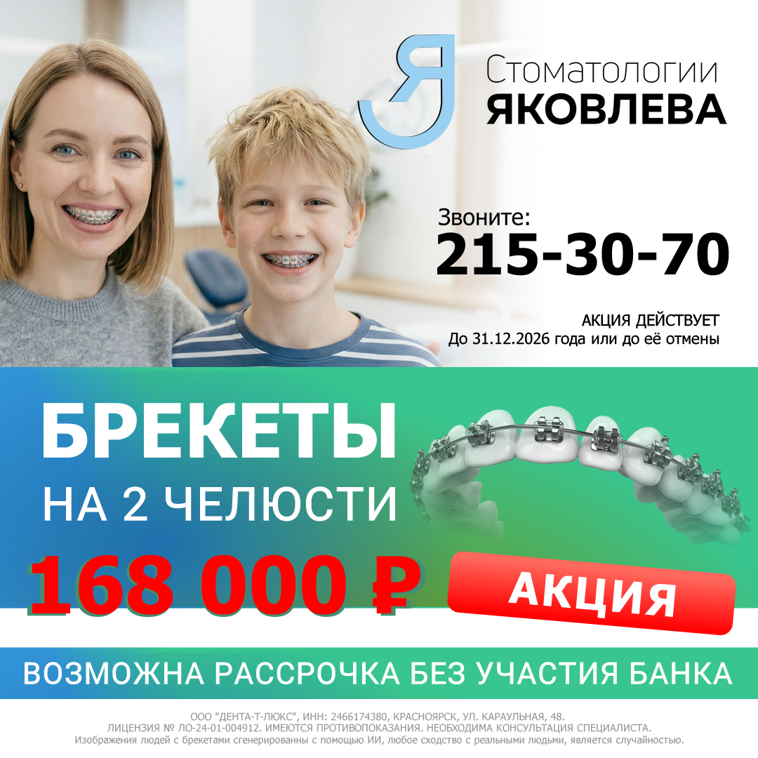 Установка брекетов в Красноярске - Стоматологии Яковлева
